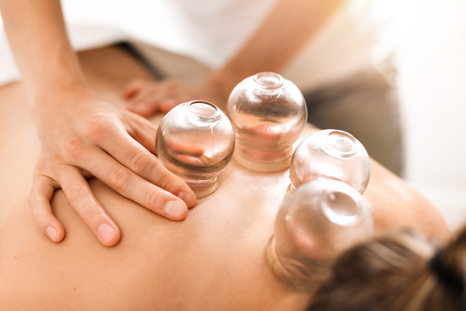 Embrace the Power of Ancient Chinese Cupping Therapy