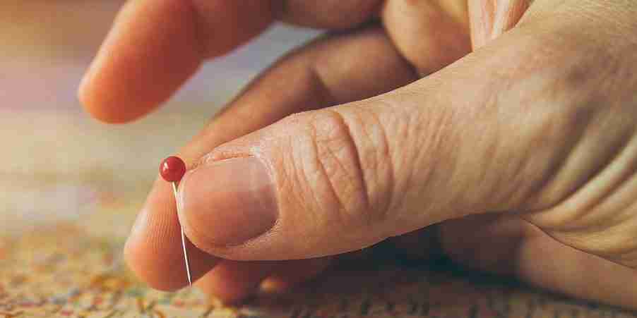 Unlocking Acupuncture Benefits: Traditional Chinese Medicine