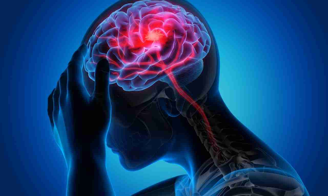 Migraine – Symptoms & Causes