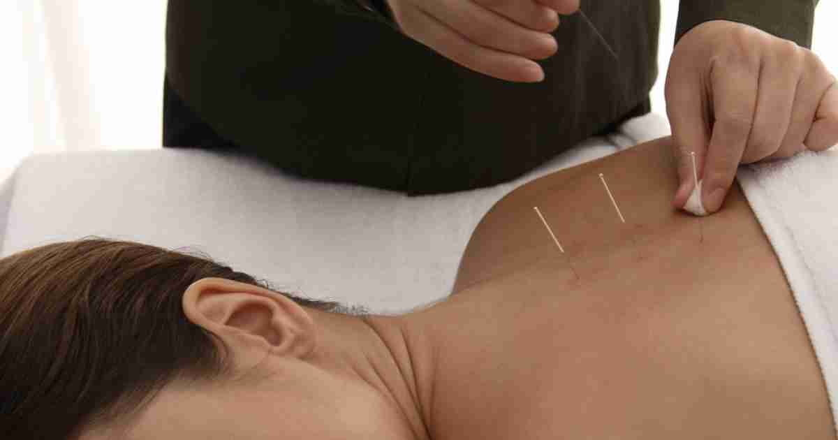 Secrets of Acupuncture Therapy & its Techniques
