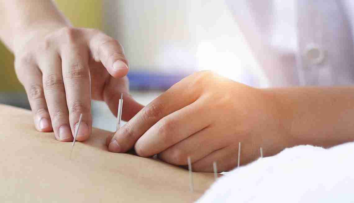 Acupuncture for Persistent Back Pain Relief