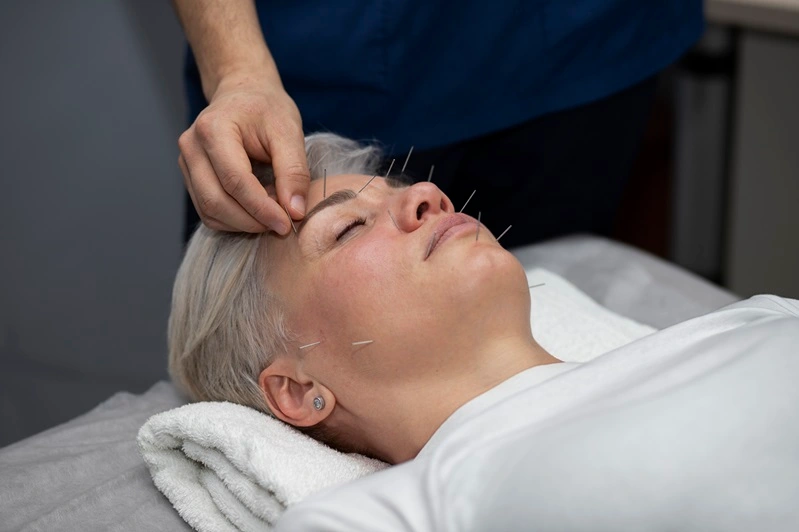 Acupuncture for Hormonal Health