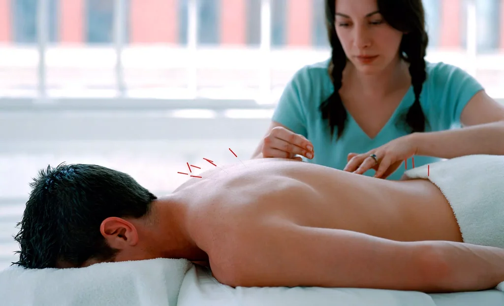 Acupuncture Treatment in Bangalore: A Natural Relief for Full-Body Pain