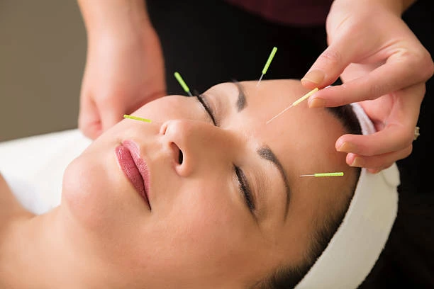 How Acupuncture Treatment Works for Hormonal Pain