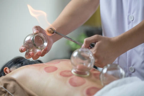 advantages of cupping therapy​ 